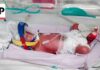 Rare identical quadruplets born in Australia