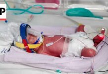 Rare Birth Stuns Doctors Worldwide Rare identical quadruplets born in Australia
