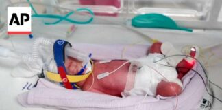 Rare Birth Stuns Doctors Worldwide Rare identical quadruplets born in Australia