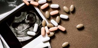 Ultrasound images with assorted pills on a brown surface