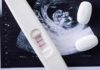 Justice Department Eyes Abortion Restrictions Pregnancy test with two lines on an ultrasound print