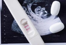 Pregnancy test with two lines on an ultrasound print